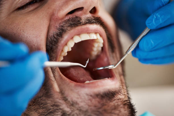 Best Dentist for Tooth Abscess  in Highspire, PA